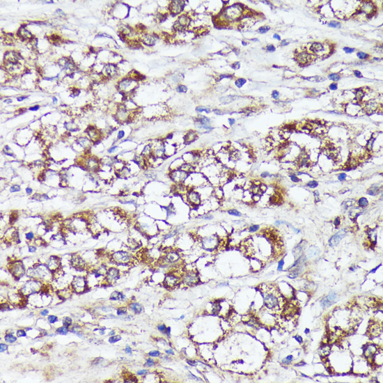 Anti-MTHFD2 Antibody (CAB10386)