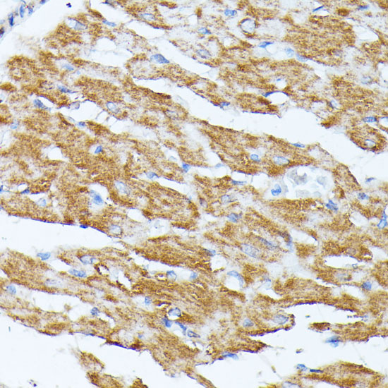 Anti-KCNJ15 Antibody (CAB15282)