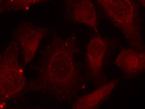 Anti-Phospho-Merlin-S518 Antibody (CABP0414)