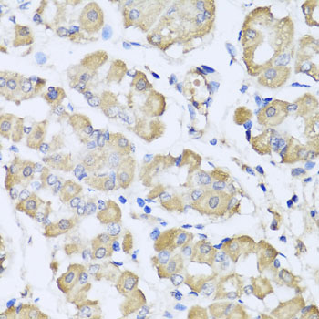 Anti-L2HGDH Polyclonal Antibody (CAB7996)