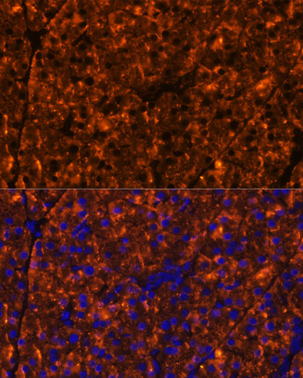 Anti-SERPINI2 Antibody (CAB11732)