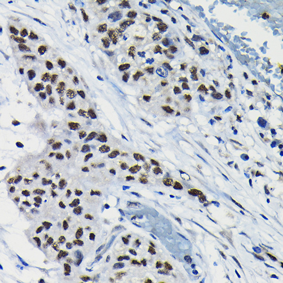 Anti-ARID3A Antibody (CAB7668)