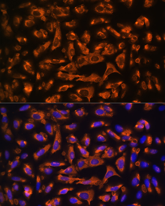 Anti-DAG1 Antibody (CAB10076)