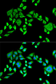 Anti-SH3GL2 Antibody (CAB5701)