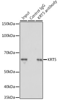 Anti-KRT5 Antibody (CAB2662)