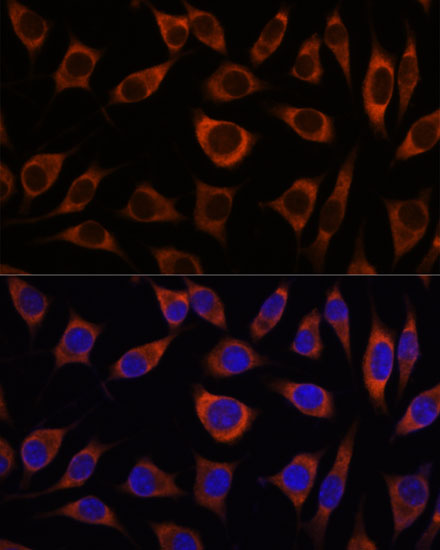 Anti-CTNNA3 Antibody (CAB16519)