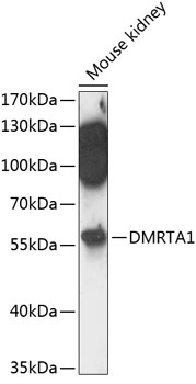Anti-DMRTA1 Antibody (CAB14338)