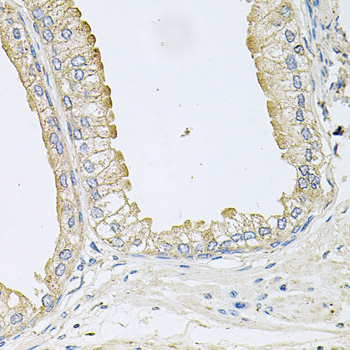 Anti-ANKH Polyclonal Antibody (CAB9881)