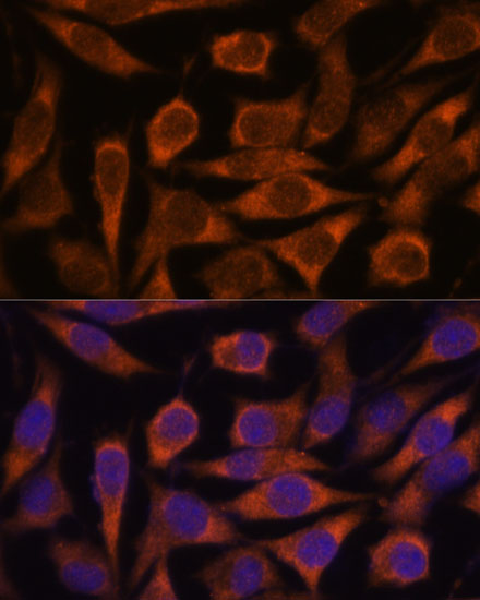 Anti-ME3 Antibody (CAB15787)