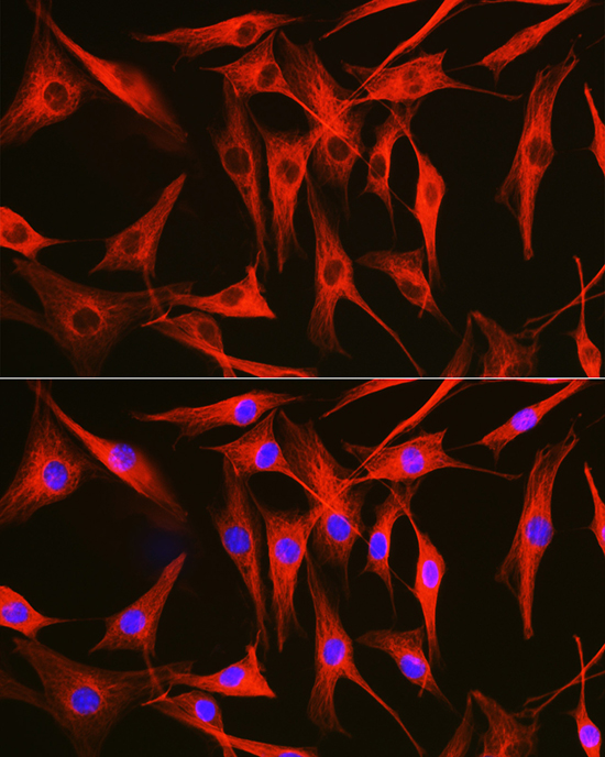 Anti-Tubulin alpha 1b Antibody (CABC024)