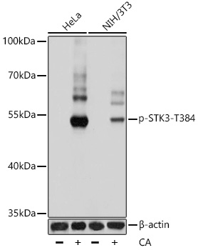 Anti-Phospho-STK3-T384 Antibody (CABP0935)