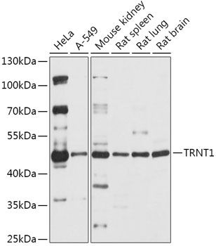 Anti-TRNT1 Antibody (CAB17699)