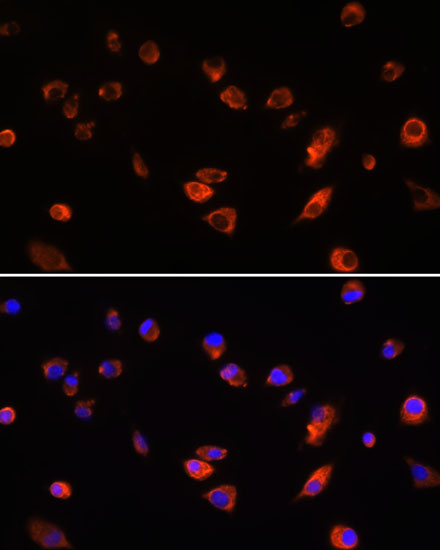 Anti-ARL13B Antibody (CAB5200)