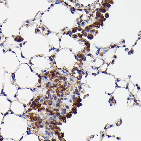 Anti-GAPDH Antibody (CABC027)