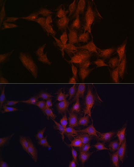 Anti-NFS1 Antibody (CAB6668)