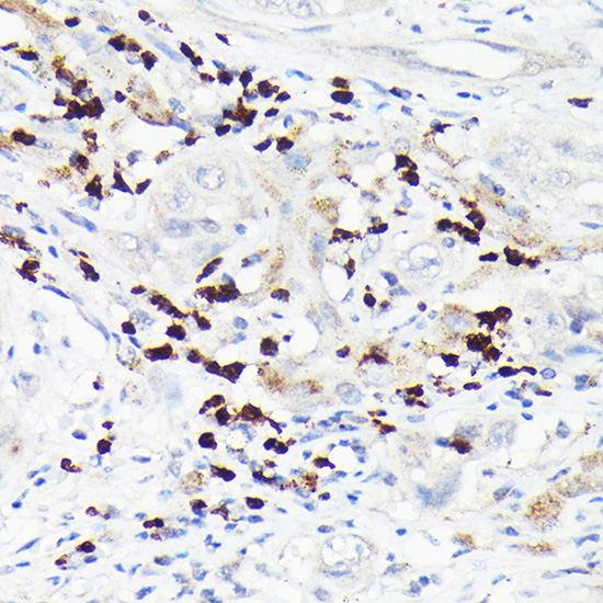 Anti-MMP8 Antibody (CAB1963)