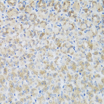 Anti-ARFGAP3 Polyclonal Antibody (CAB8204)