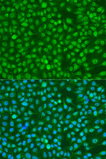 Anti-Phospho-BRCA1-S1423 Antibody (CABP0232)