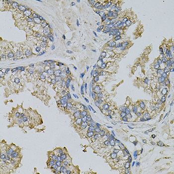 Anti-PSAT1 Antibody (CAB14124)