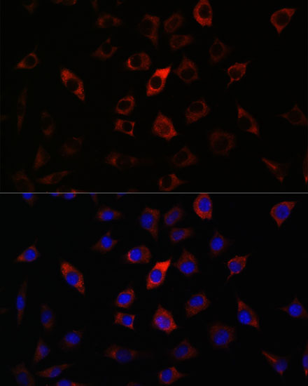 Anti-RAB27A Antibody [KO Validated] (CAB1934)