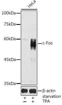 Anti-c-Fos Antibody (CAB2444)