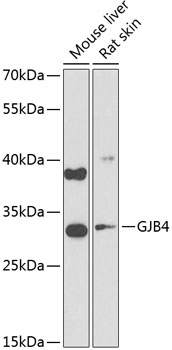 Anti-GJB4 Polyclonal Antibody (CAB9888)