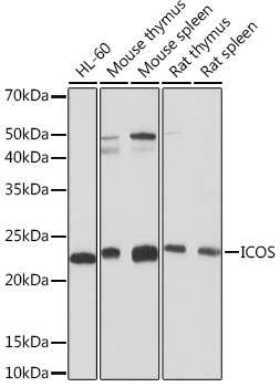 Anti-ICOS Antibody (CAB5130)