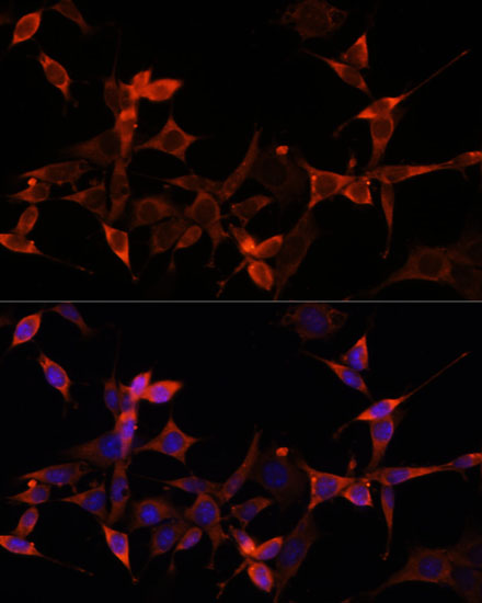 Anti-AKT1S1 Antibody (CAB6238)