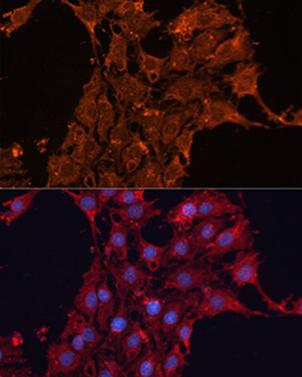 Anti-ADAM12 Antibody (CAB7940)