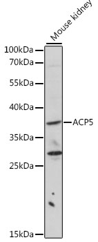 Anti-ACP5 Antibody (CAB2528)