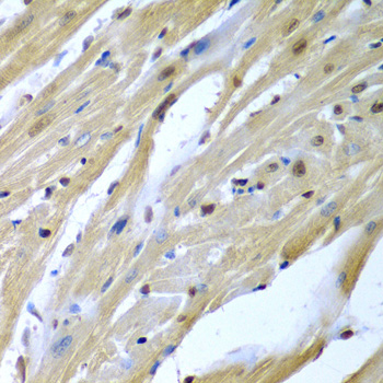 Anti-TUSC2 Antibody (CAB7075)