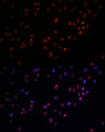 Anti-MATR3 Antibody (CAB5905)