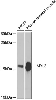 Anti-MYL2 Antibody (CAB5473)