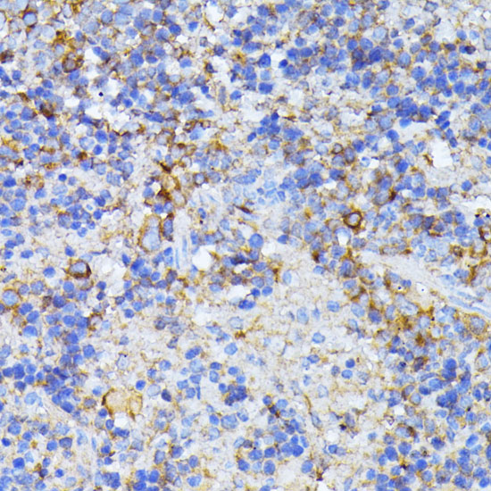 Anti-CAD protein Polyclonal Antibody (CAB8344)