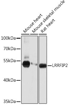 Anti-LRRFIP2 Antibody (CAB17046)