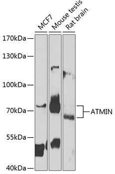 Anti-ATMIN Antibody (CAB7272)