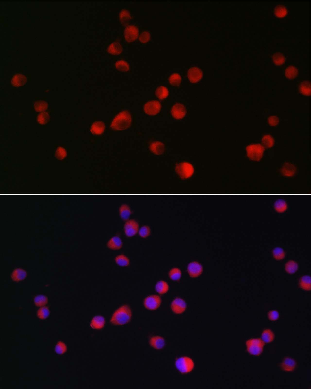 Anti-ALK Antibody (CAB0766)