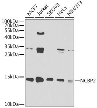 Anti-NCBP2 Antibody (CAB7293)