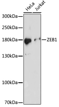 Anti-ZEB1 Antibody (CAB16981)