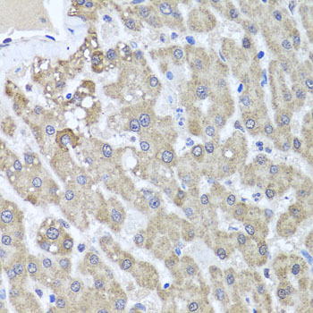 Anti-ALKBH4 Antibody (CAB7812)