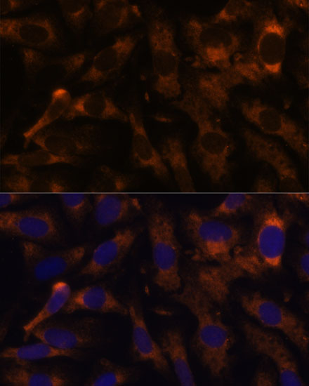 Anti-SUCLG2 Polyclonal Antibody (CAB8976)