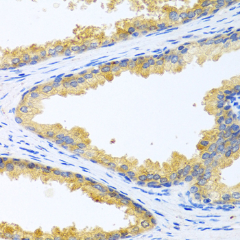 Anti-KLK11 Antibody (CAB12565)