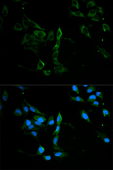 Anti-MVP Antibody (CAB1980)