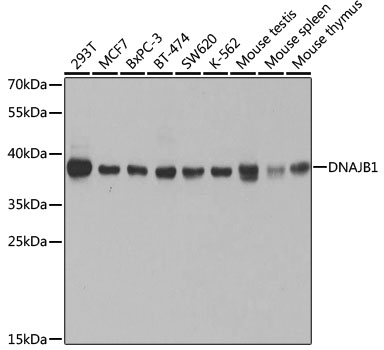 Anti-DNAJB1 Antibody [KO Validated] (CAB5504)