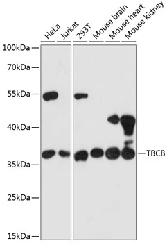 Anti-TBCB Antibody (CAB13248)