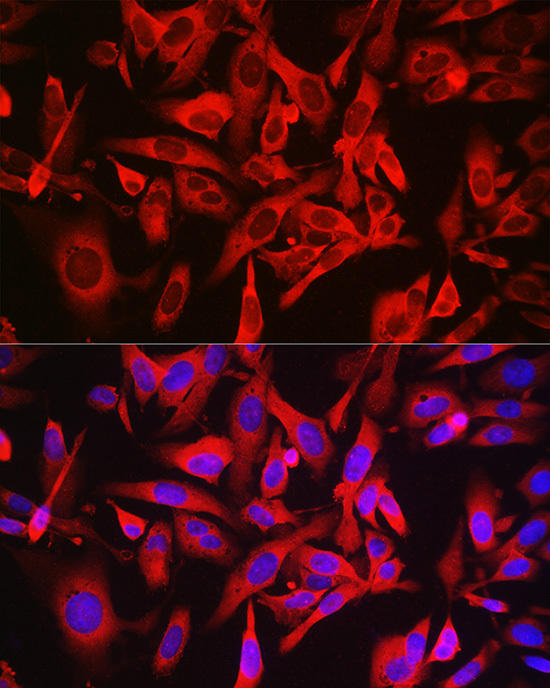 Immunofluorescence analysis of U2OS cells using CASTOR1 Rabbit pAb at dilution of 1:50 (40x lens). Blue: DAPI for nuclear staining.