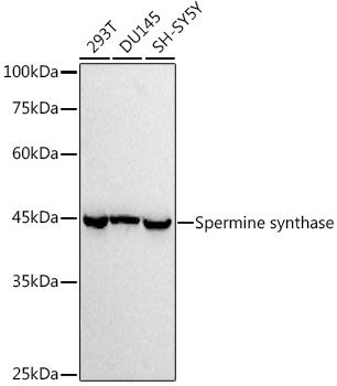 Western blot analysis of extracts of various cell lines, using at 1:1000 dilution. Secondary antibody: HRP Goat Anti-Rabbit IgG (H+L) at 1:10000 dilution. Lysates/proteins: 25ug per lane. Blocking buffer: 3% nonfat dry milk in TBST. Detection: ECL Basic Kit. Exposure time: 10s.