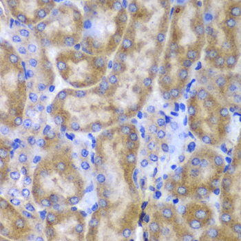 Anti-SPARC Antibody (CAB1615)