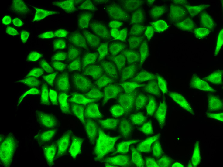 Anti-APRT Antibody (CAB5456)