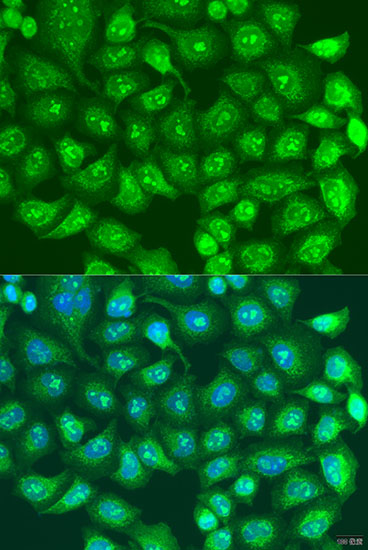 Anti-SPICE1 Antibody (CAB7855)